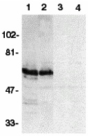 SODD Peptide