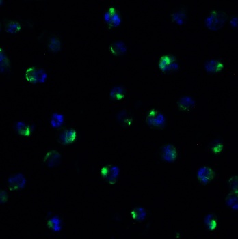 PEX10 (CT) Antibody