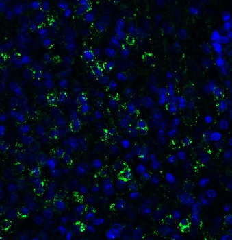 PEX10 (CT) Antibody