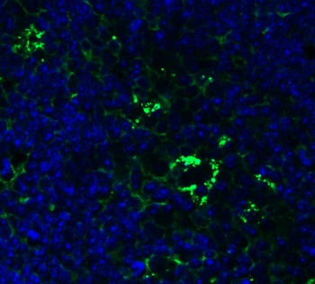 PEX10 (CT) Antibody