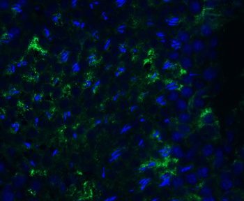 PEX10 (CT) Antibody