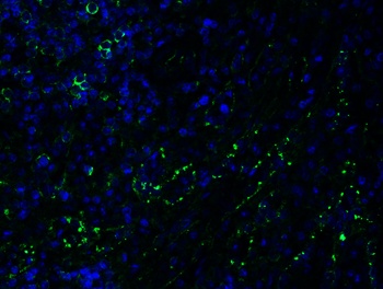 PEX3 (CT) Antibody