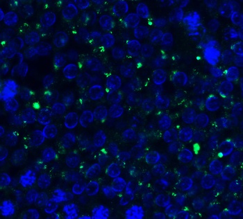 PEX3 (CT) Antibody