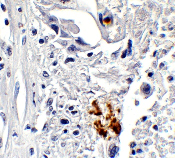 NCOA4 (IN) Antibody