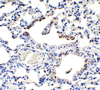 NCOA4 Antibody