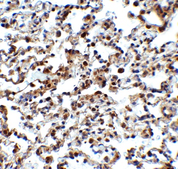NCOA4 (IN) Antibody