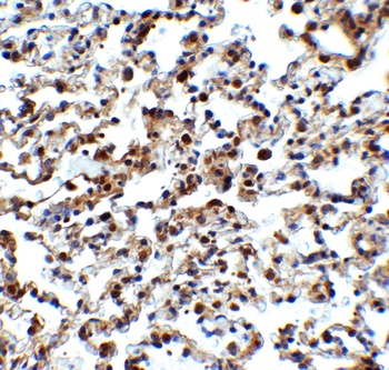 NCOA4 Antibody