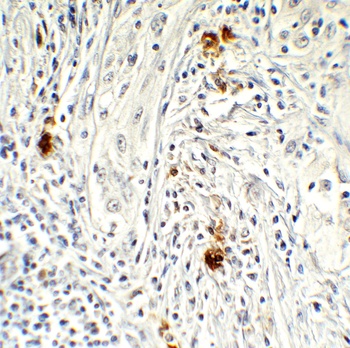 AIFM2 (IN) Antibody