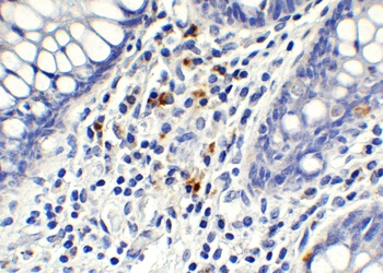 AIFM2 (CT) Antibody