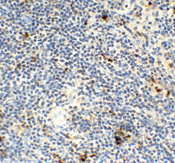 AIFM2 (CT) Antibody