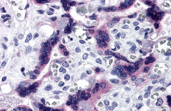 TTBK2 Antibody