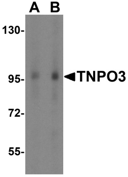 TNPO3 Antibody