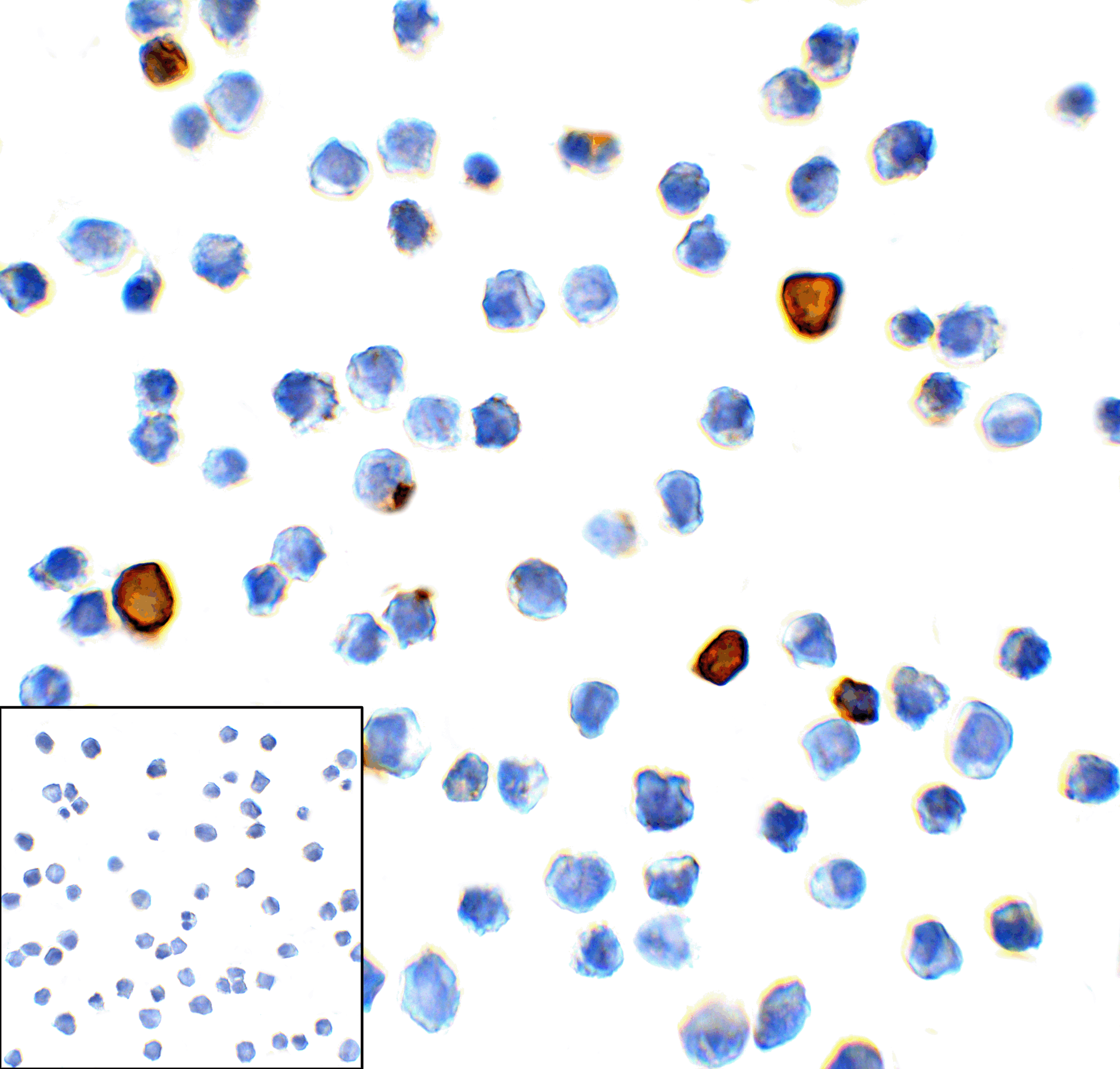 HAVCR2 Antibody