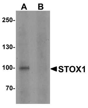 STOX1 Antibody