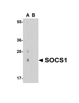 SOCS1 Antibody