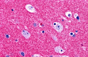 RIMS2 Antibody