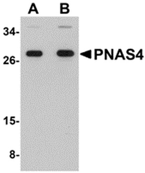 DESI2 Antibody