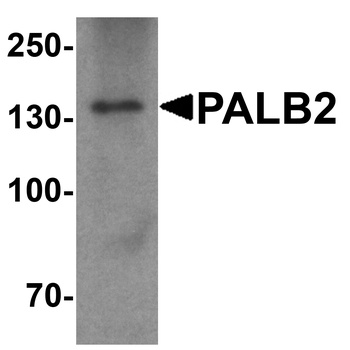 PALB2 Antibody