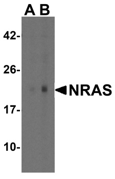 NRAS Antibody
