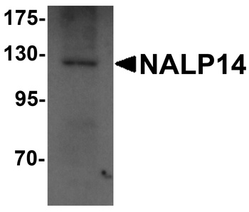 NALP14 Antibody
