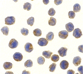 TBK1 Antibody