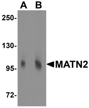 MATN2 Antibody