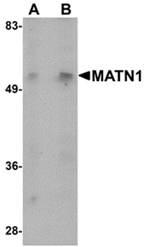 MATN1 Antibody