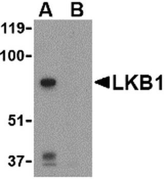 STK11 Antibody