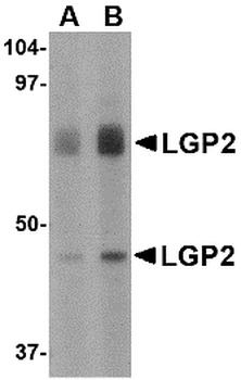 DHX58 Antibody