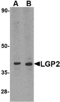 DHX58 Antibody