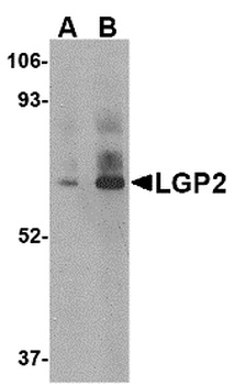DHX58 Antibody