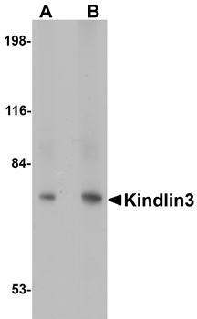 FERMT3 Antibody