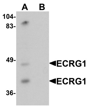 TMPRSS11A Antibody