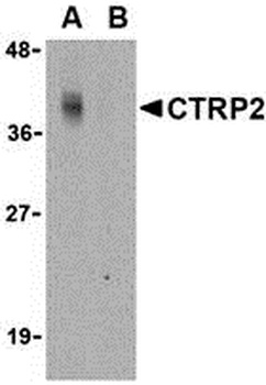 C1QTNF2 Antibody