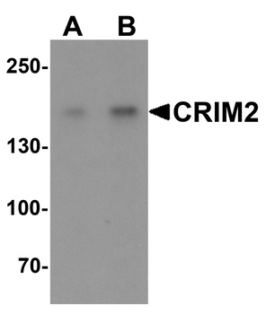 CRIM2 Antibody