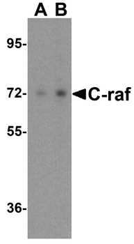 RAF1 Antibody