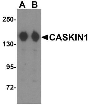 CASKIN1 Antibody
