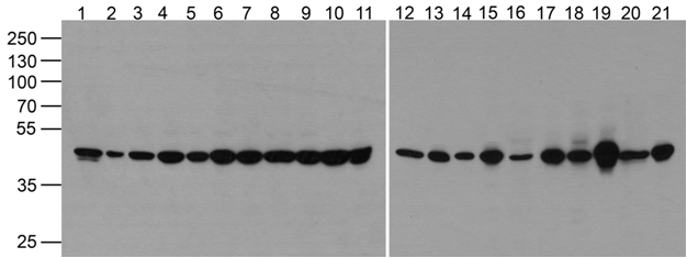 TUBA1A Antibody