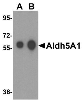 ALDH5A1 Antibody
