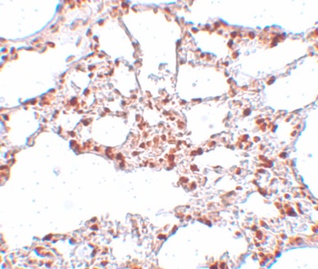 ZSCAN4 Antibody