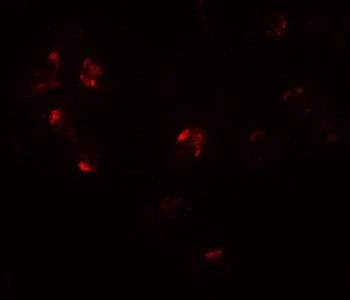 ZNF821 Antibody