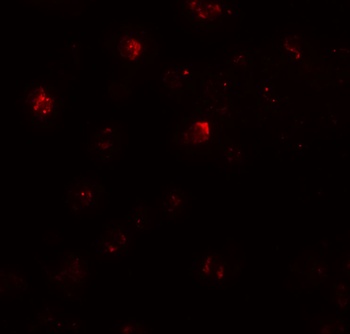 ZNF687 Antibody