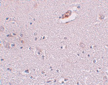 ZNF536 Antibody