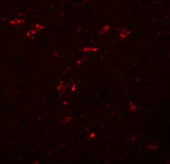 ZNF536 Antibody