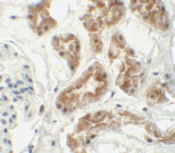 ZNF346 Antibody