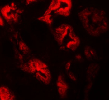 ZNF346 (CT) Antibody