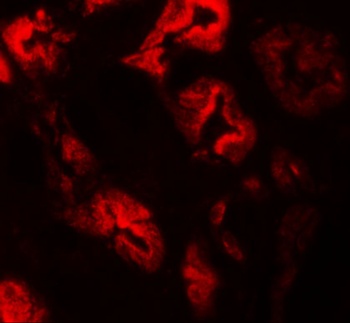 ZNF346 Antibody