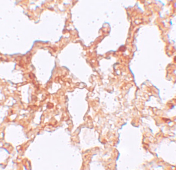 ZMYM1 Antibody