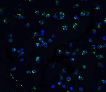 DAPK3 Antibody