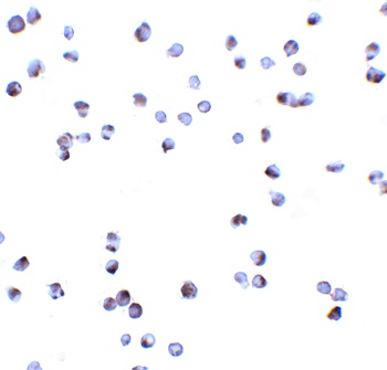 DAPK3 Antibody